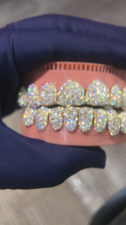 Custom Moissanite Grillz